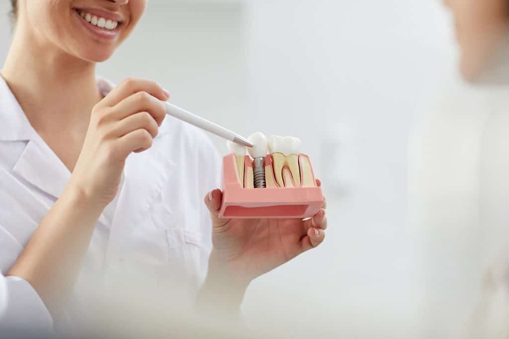 Are Dental Implants Covered By Dental Insurance?