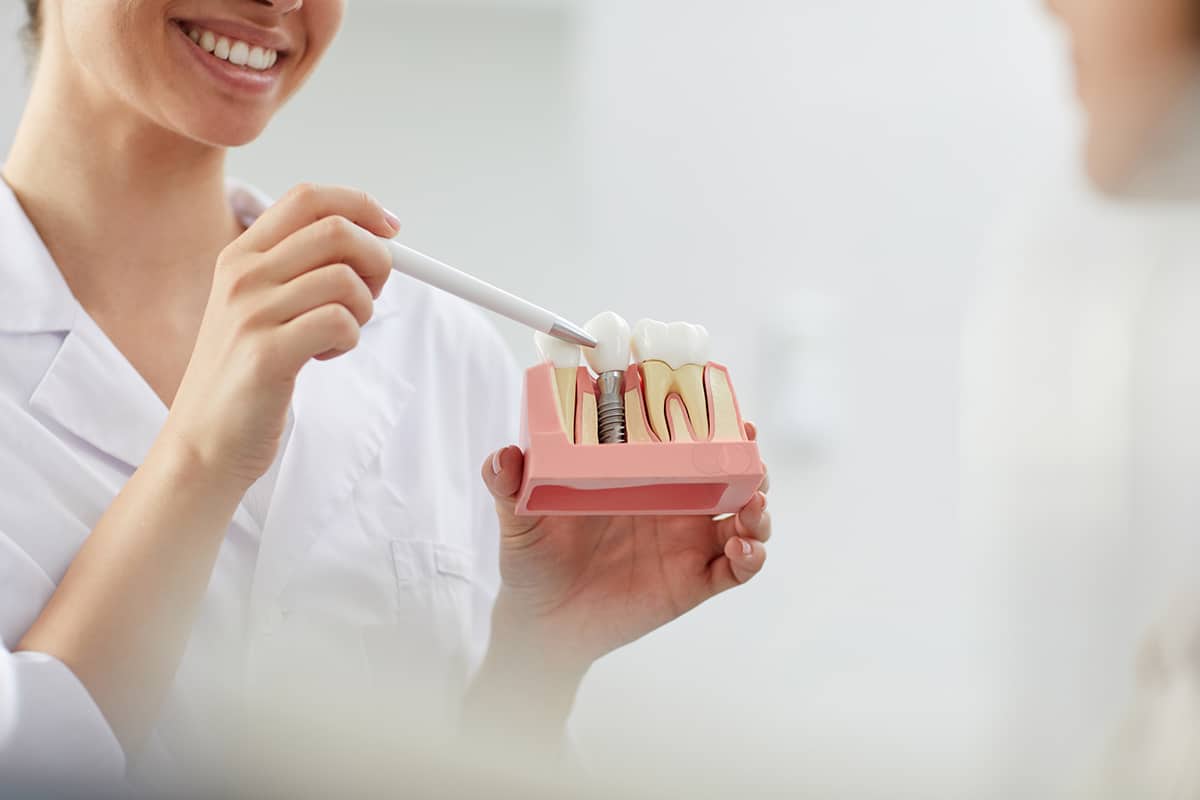 Are Dental Implants Covered By Dental Insurance? Fullerton Oral Surgery
