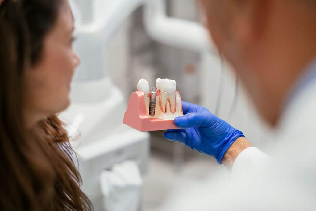 How Long Do Dental Implants Last?